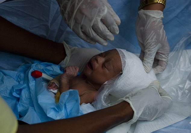 Триседмично бебе оцеля под развалините в Хаити 7 дни