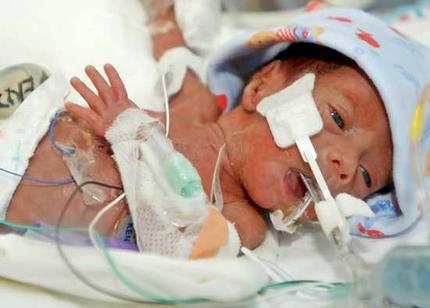 Оперираха 500-грамовото бебе на 62-годишната Красимира