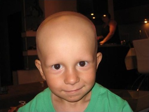 Отстраниха огромен тумор от тригодишния Майкъл, предстои финалната битка