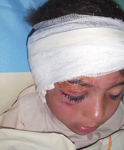 Каракачанка нахапа 5-годишно дете по главата