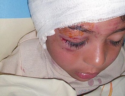 Каракачанка нахапа 5-годишно дете по главата