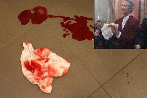Ромски лидер наръга съпругата си с нож в гърба