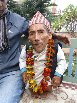 56-сантиметров непалец е най-ниският мъж на планетата