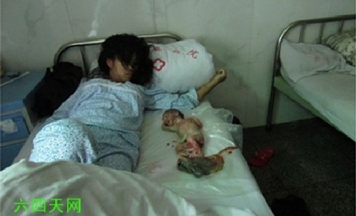 Шок и ужас! Труп на абортирано по принуда бебе разбуни Китай (18+)