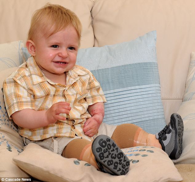 Малко дете без крака се радва на протезите, подарени му за първия му рожден ден 