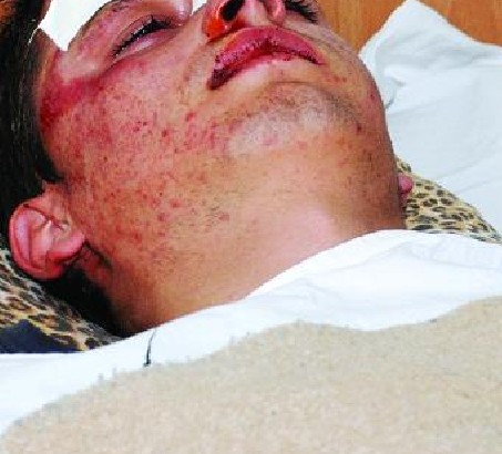 Млада майка счупи носа на пиян с метален бокс в Радомир