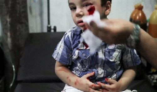 Реки от кръв в Сирия: Снимки показват град след въздушен удар (СНИМКИ/ВИДЕО)