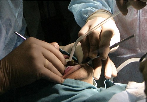 Зъболекари източвали здравната каса с мъртви души 