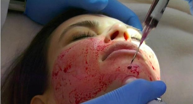 Ким Кардашиян стряска с кървясало лице