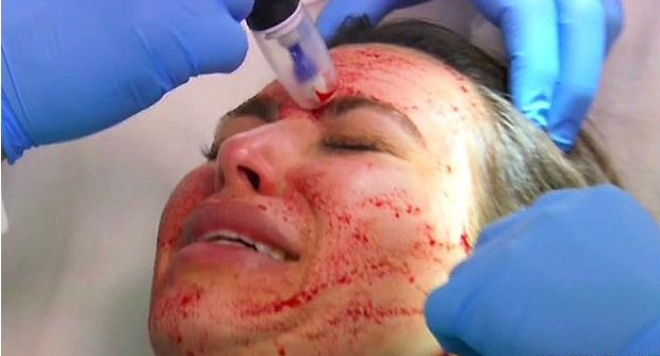 Ким Кардашиян стряска с кървясало лице