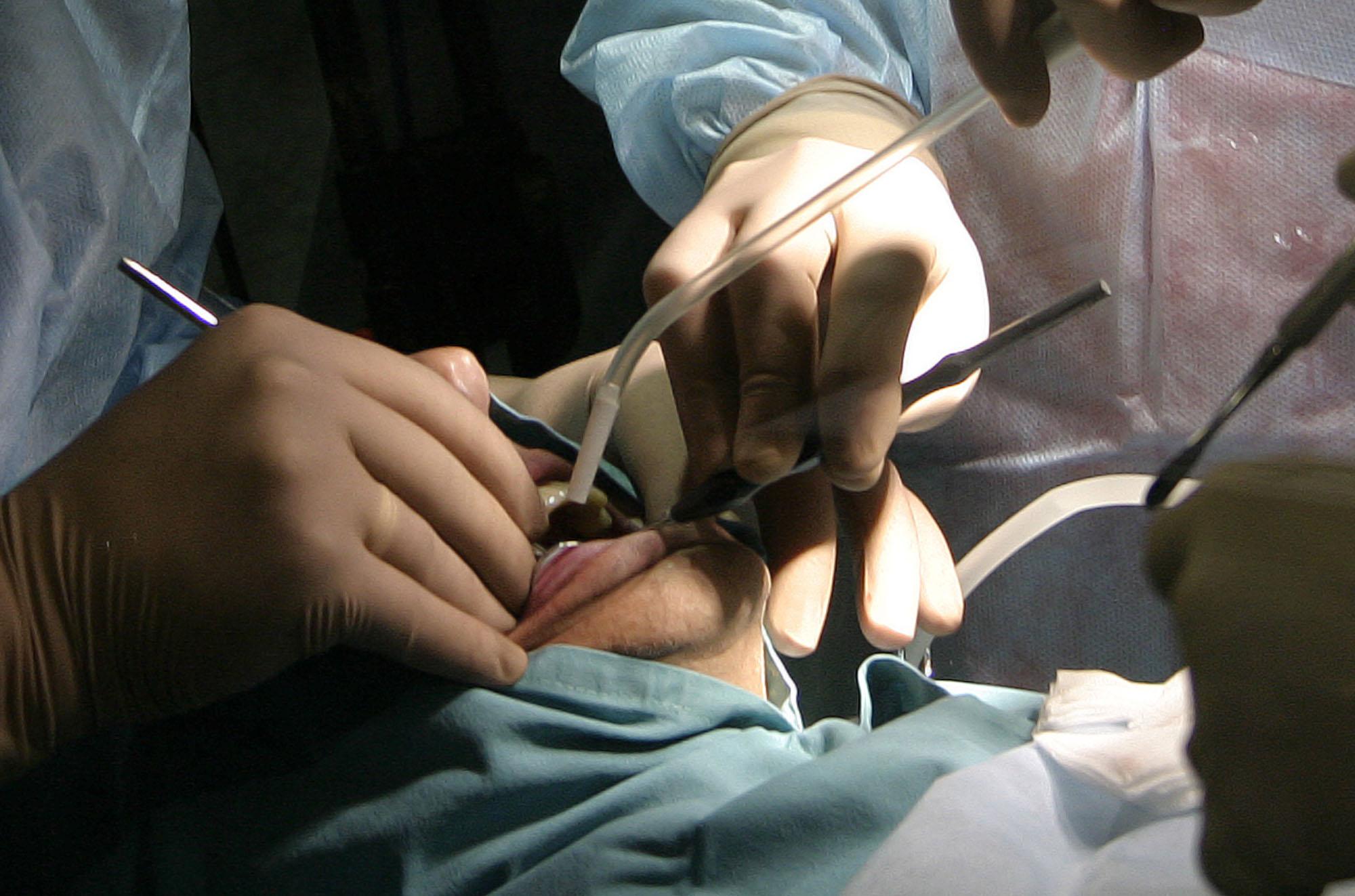 Прокуратурата погна зъболекар, източил Здравна каса с фалшиви пломби