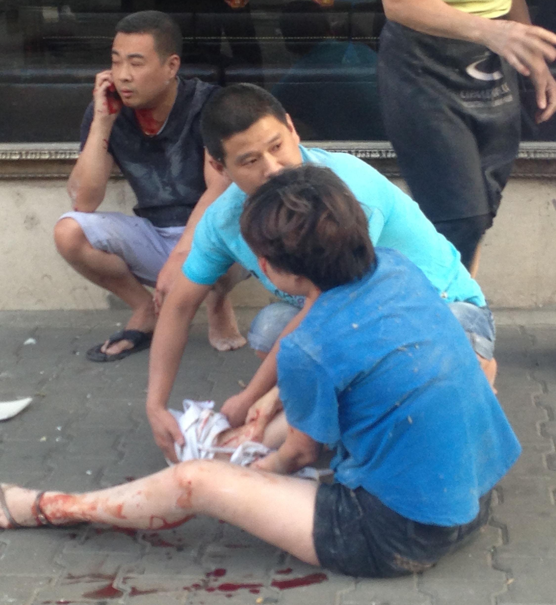 Китаец, испанка и турчин сред ранените от експлозията