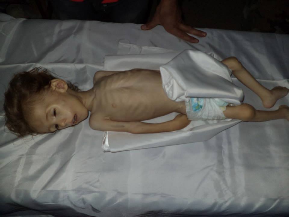 Деца гладуват до смърт заради кризата в Сирия 