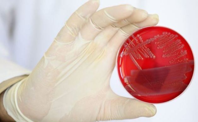 Учени създадоха принципно нов антибиотик-убиец на бактерии