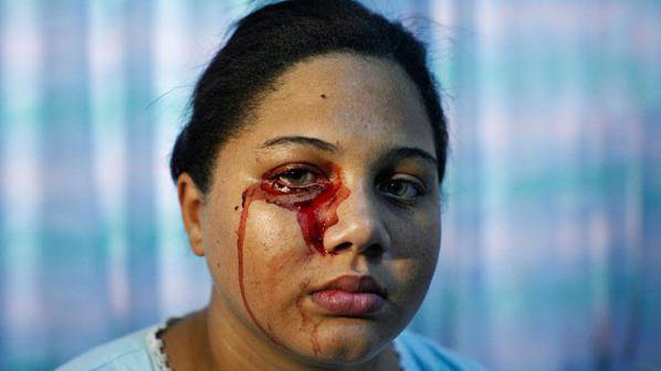 Жена плаче с кървави сълзи от 4 години, иска да се самоубие