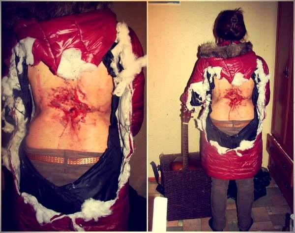 Ето страшните рани от взрив на граната по гърба на украинско момиче (СНИМКИ 18+)