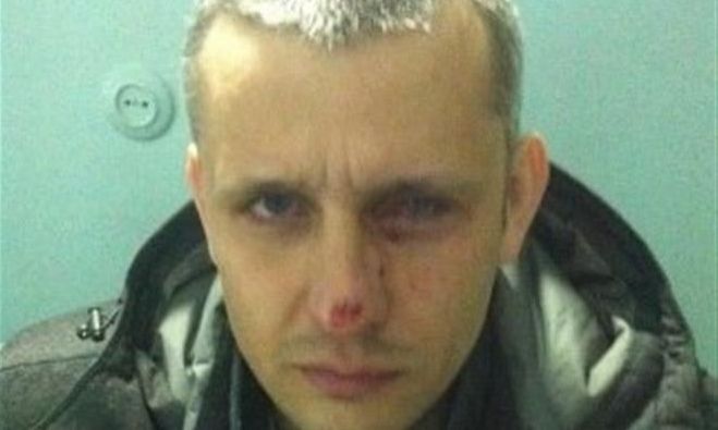 Война в Киев! Прострелян журналист издъхна в болницата (НА ЖИВО)