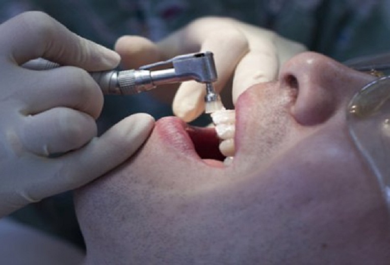 Безпрецедентен казус: Пациент съди стоматолог за болка от калпава металокерамика