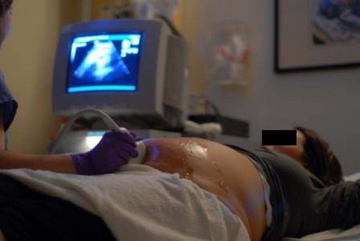 Жена се оказа бременна след направен в болница аборт! 