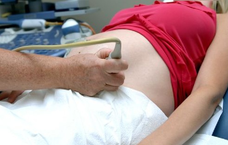 Бременна дава гинеколози на съд заради неуспешен аборт