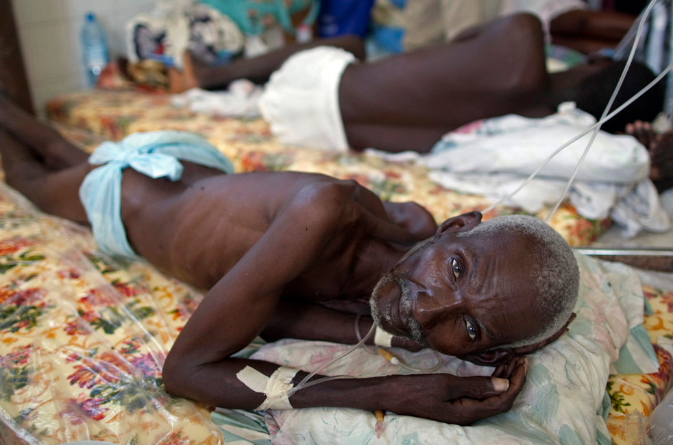 200 починаха от холера в Камерун