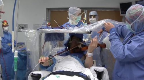 Музикант свири на цигулка, докато му оперират мозъка (ВИДЕО)