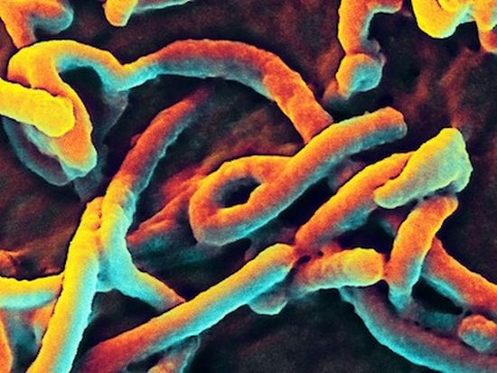 Неизвестни откраднаха банки с кръв на заразени от ебола