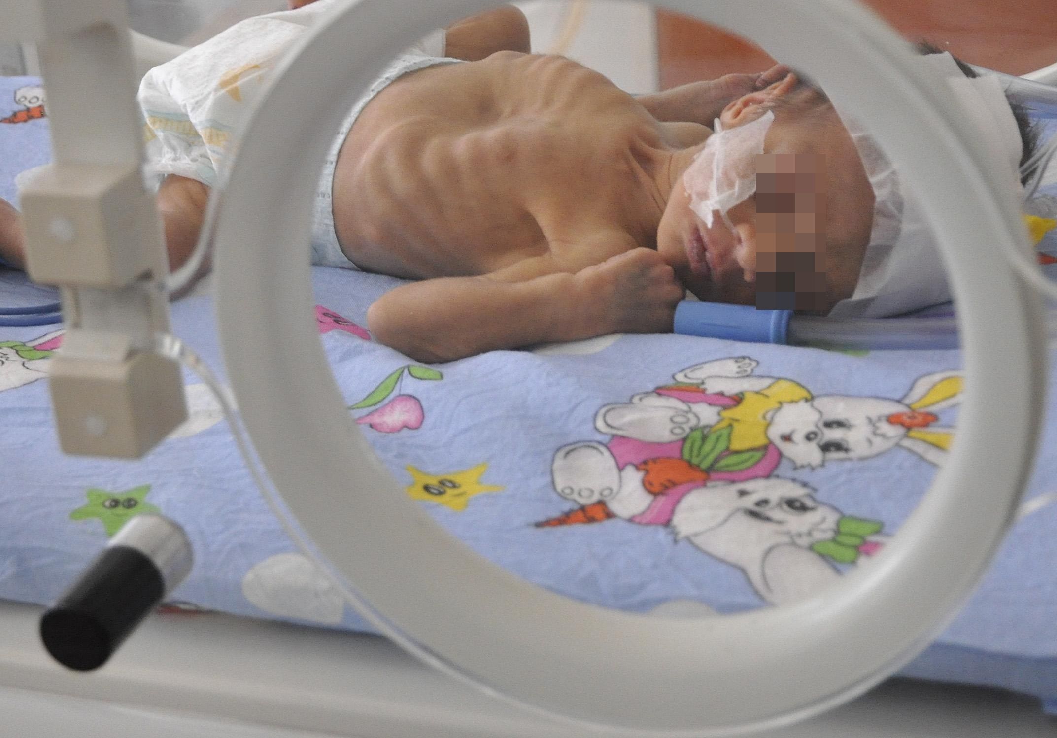 Родилката от Сърница роди преждевременно, борят се за живота на детето