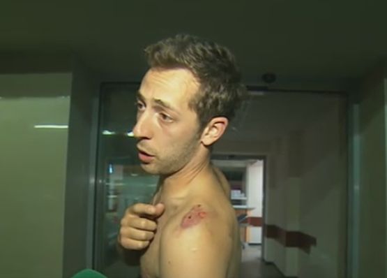 Участник в боя в Орландовци: Цигани разцепиха крака на брат ми с брадва