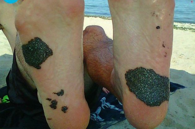 Нещо става на плажа в Аркутино - мазни черни парчета лепнат по краката на туристи