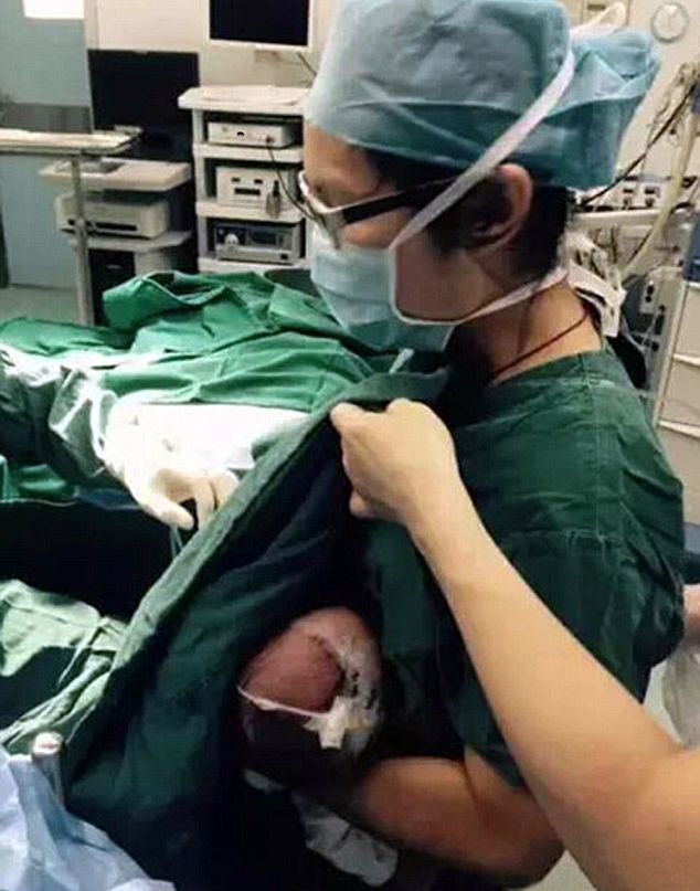 Медицинска сестра накърми детенце по време на операция (СНИМКИ)