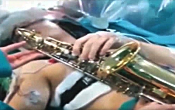 Уникално: Пациент свири на саксофон по време на мозъчна операция (ВИДЕО)