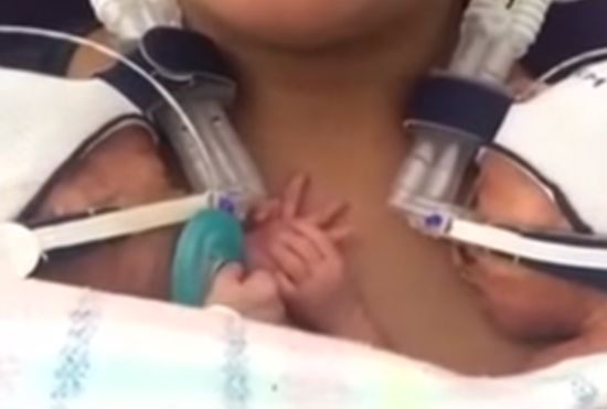 Трогателен клип с недоносени близнаци разнежи потребителите в мрежата (ВИДЕО)



