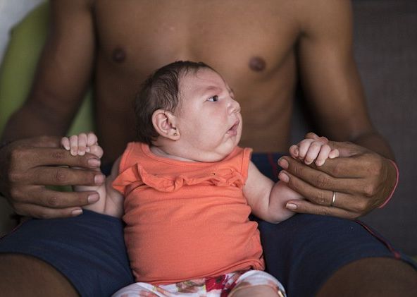 Страшният вирус Зика смалява главите на бебетата в Бразилия 