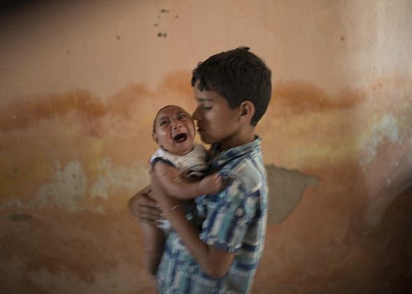 Страшният вирус Зика смалява главите на бебетата в Бразилия 