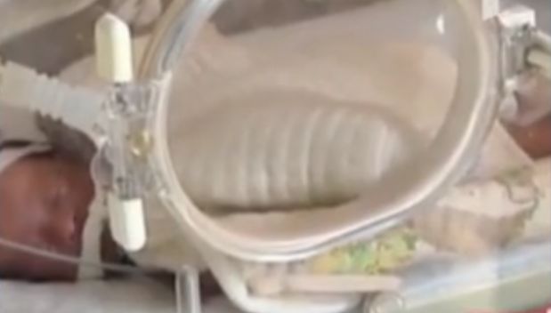 Удивително! Обявено за мъртво бебе възкръсна минута преди кремацията му (ВИДЕО)