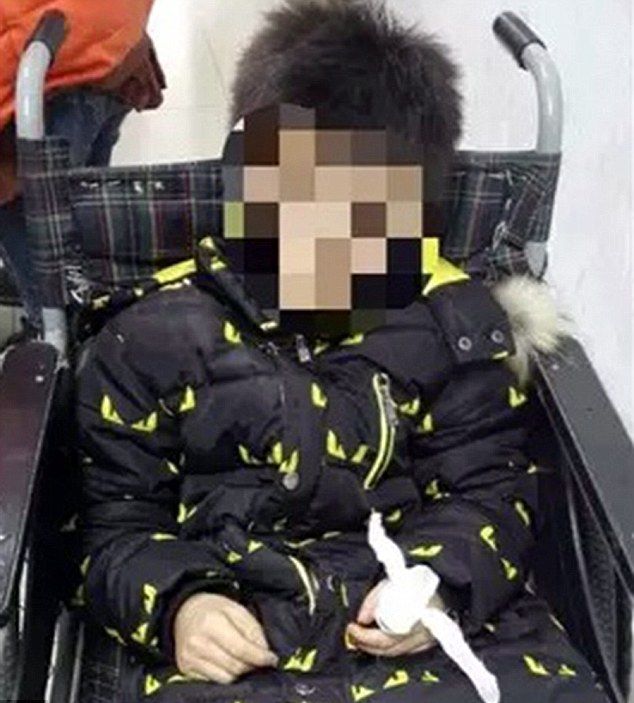 Баща се скара на сина си за игра със смартфон, детето си отряза пръста в знак на протест (СНИМКИ)