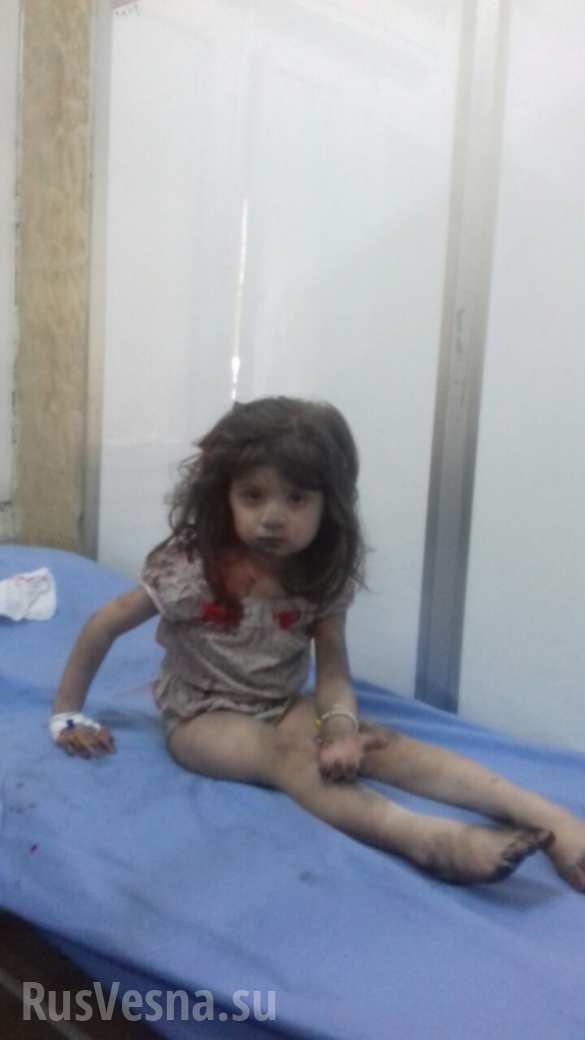 Терористите в Алепо убиват деца и жени (СНИМКИ/ВИДЕО 21+)  