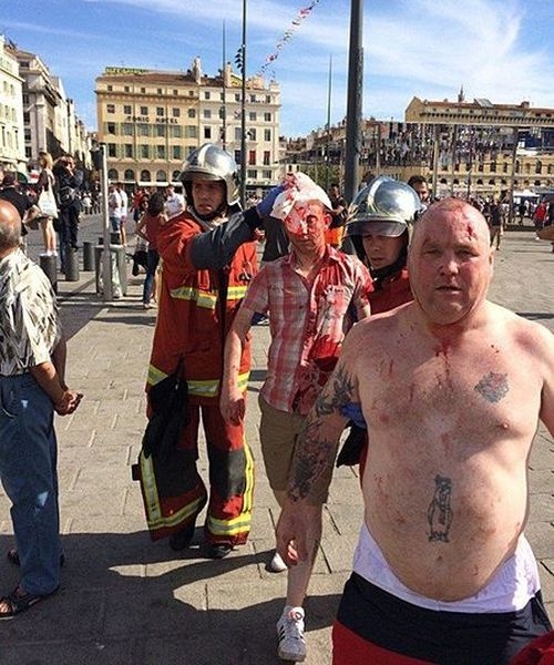 Най-малко 35-ма ранени след кървавия ад в Марсилия (ВИДЕО)
