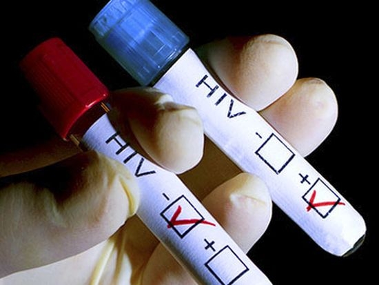 Тестове за кръв пропускат хепатит и СПИН