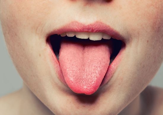 Този вид на езика сигнализира за голям проблем в тялото