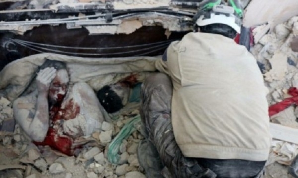 Вижте тази потресаваща СНИМКА 18+ от Сирия, която обиколи света и напомни за ужаса на войната  