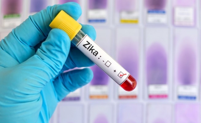 Опасният вирус Зика е открит в 16 души в Чехия
