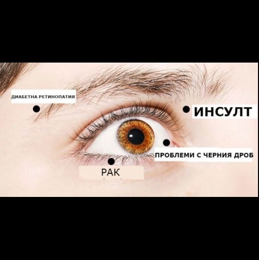 8 сигнала, с които очите ви алармират, че имате сериозни здравословни проблеми!