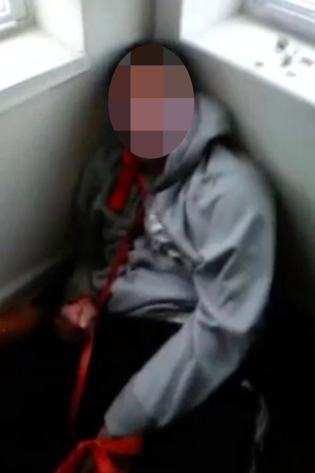 Чернокожи изтезаваха в Чикаго бяло дете-инвалид (СНИМКИ/ВИДЕО 18+)