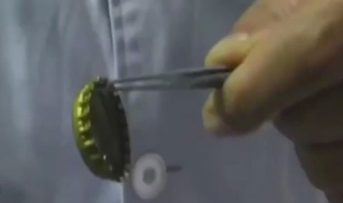 Уникално: Мъж погълна бирена капачка, лекар я извади с презерватив (ВИДЕО)