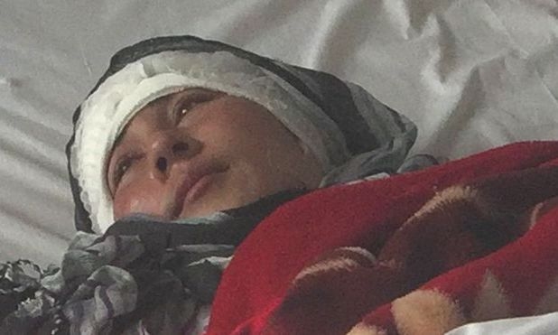 Шок и ужас! Афганистанец отряза двете уши на младата си жена за няма нищо 