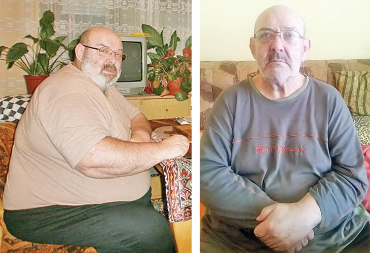 Невероятно, но факт! Българин с тежък диабет отслабна със 101 кг, спазвайки специална програма!