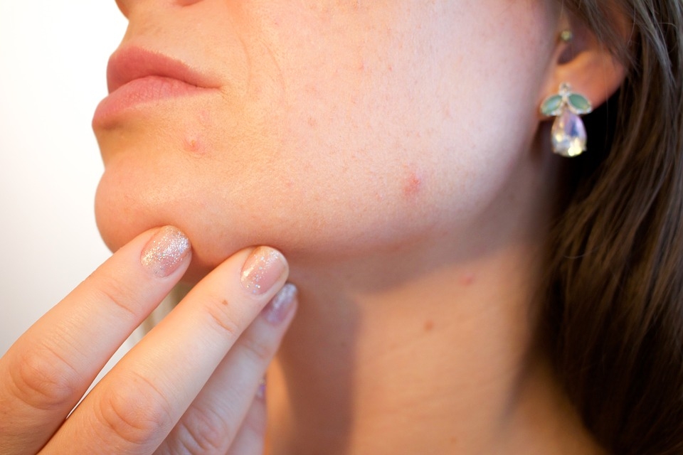 4 неща, които дори не подозирате за рака на кожата