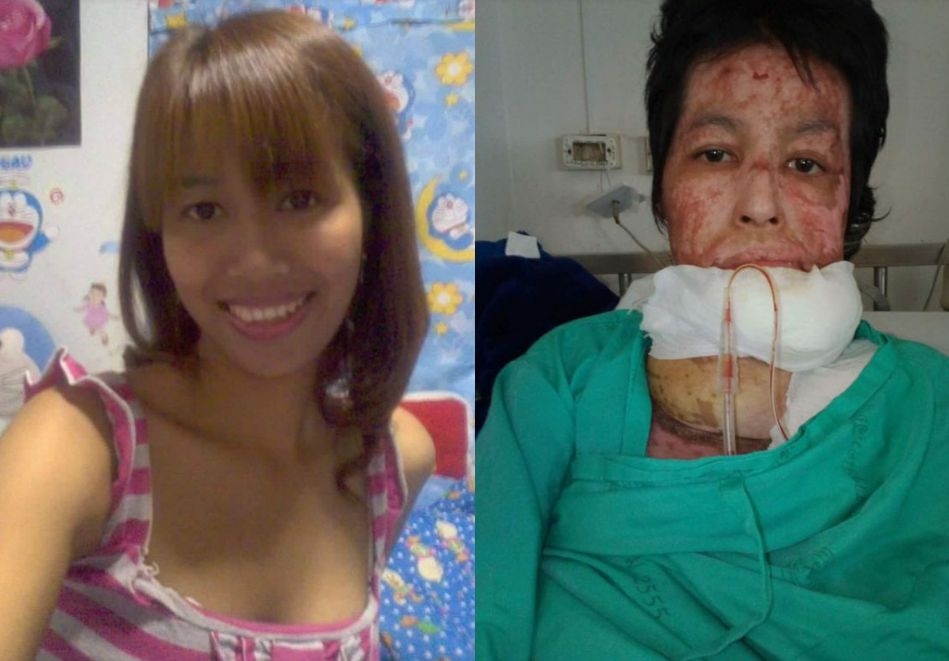 Ревнивец запали младата си съпруга заради три снимки във Фейсбук (СНИМКИ 18+)